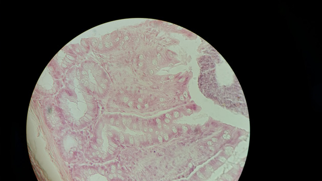 Colon Slides - Colon 003 400X
